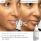 CAUDALIE - ΠΑΚΕΤΟ ΠΡΟΣΦΟΡΑΣ Vinoperfect Serum (30ml) & ΔΩΡΟ Vinosun Protect Cream SPF50 (25ml) - 2τμχ