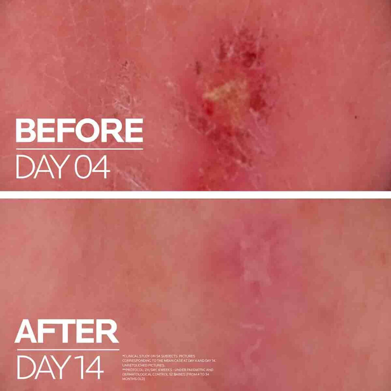 La Roche Posay Cicaplast Baume B5+ Ultra Repairing Soothing Balm 40ml