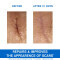 URIAGE - Bariederm Cica Cream with Cu-Zn Κρέμα Επανόρθωσης για Πρόσωπο & Σώμα για Ερεθισμένη Επιδερμίδα - 100ml