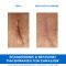 URIAGE - Bariederm Cica Cream with Cu-Zn Κρέμα Επανόρθωσης για Πρόσωπο & Σώμα για Ερεθισμένη Επιδερμίδα - 40ml