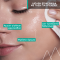 URIAGE - Hyseac Purifying Toner Εξυγιαντική & Τονωτική Λοσιόν για Λιπαρή Επιδερμίδα - 250ml
